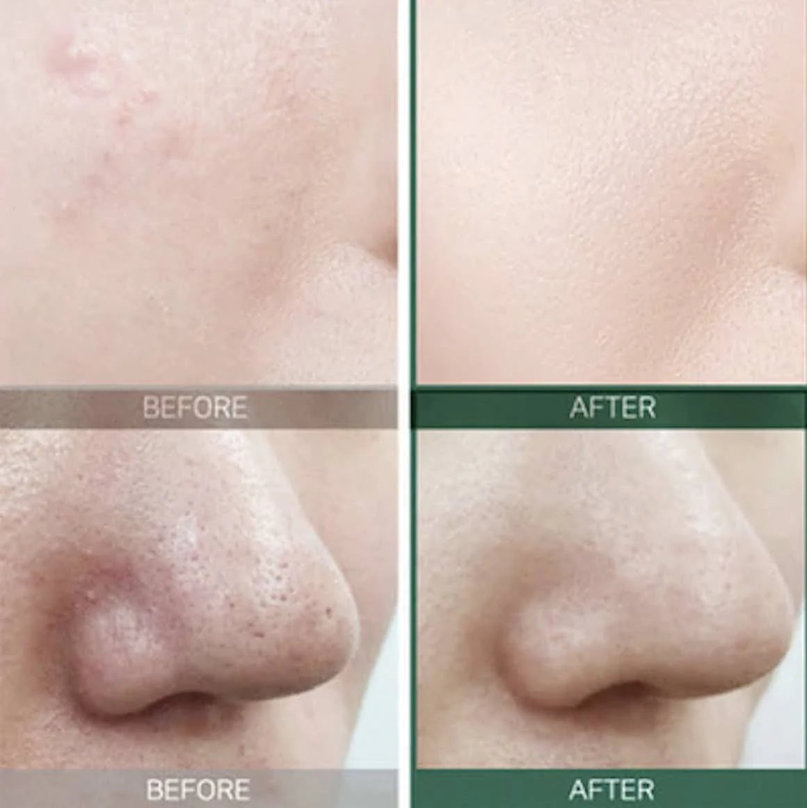 SOME BY MI - AHA, BHA, PHA 30 DAYS MIRACLE TONER